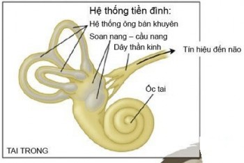 Rối loạn tiền đình... vì thuốc