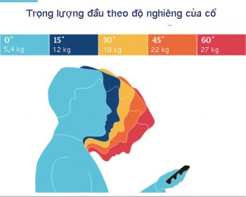 Cảnh báo: Cả một thế hệ sẽ bị đau cổ do điện thoại thông minh