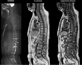 Phát hiện sớm bệnh lý mạch máu, ung thư, bệnh xương khớp…  nhờ cộng hưởng từ