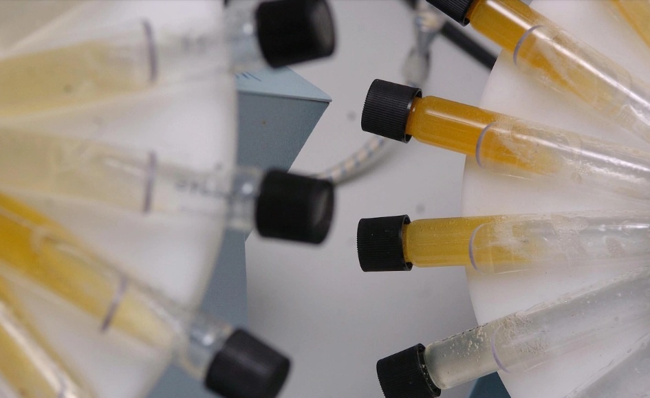 Xét nghiệm nước tiểu đơn giản phát hiện ung thư buồng trứng