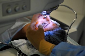 Phát hiện nhiều vấn đề mới phát sinh sau khi phẫu thuật LASIK