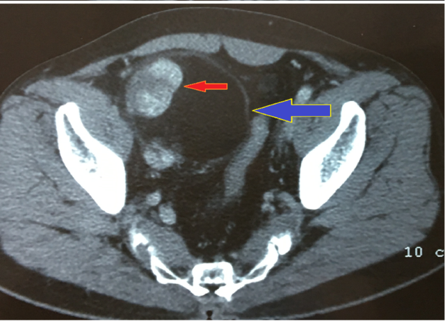 Cụ ông suýt chết vì bệnh viện quận 'liều' mổ phình động mạch