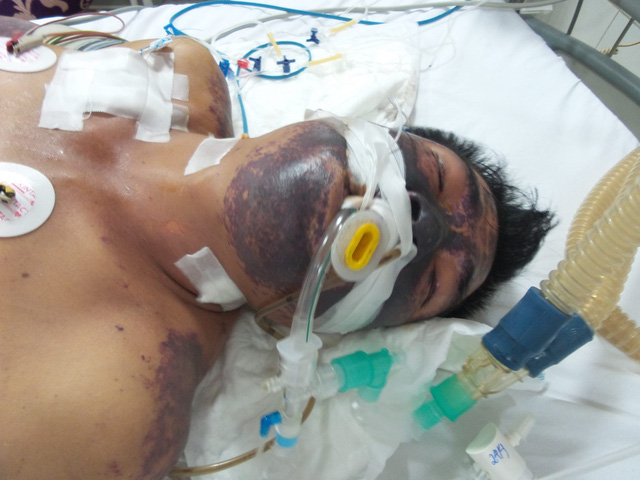 de mac benh chet nguoi vi nhung hieu lam nay