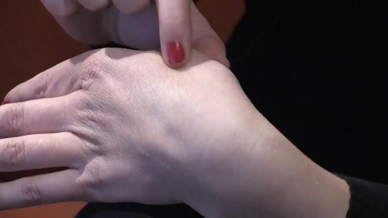 Microchip cấy dưới da có thể tích hợp thẻ tín dụng ở Thụy Điển