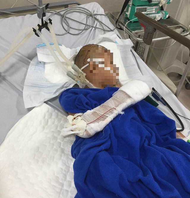 Bé trai 9 tuổi bị đối tượng nghi ngáo đá chém liên tục vào đầu